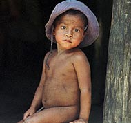 Un ni�o con desnutrici�n en su casa de Guatemala. (Foto: AP)