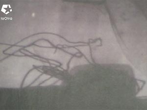 La radiografa realizada a la bomba de Vallecas antes de desactivarlas: en ella se aprecian dos extremos de cable sueltos. (Foto: LaOtra)