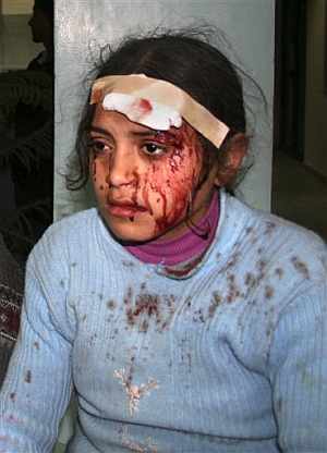 Una niña herida en el atentado. (Foto: AFP)