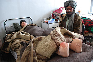 Un joven afgano con los dedos de los pies amputados por congelación, en el hospital de Herat. (Foto: M. Bernabé) Un joven afgano con los dedos de los pies amputados por congelación, en el hospital de Herat. (Foto: M. Bernabé)