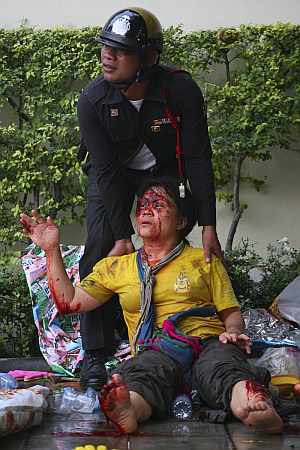 Un manifestante, herido en el suelo. (Foto: AP)