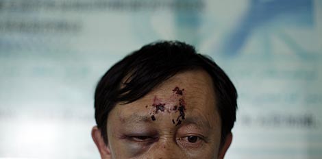 Un hombre herido durante los altercados en Urumqi. | Reuters Un hombre herido durante los altercados en Urumqi. | Reuters