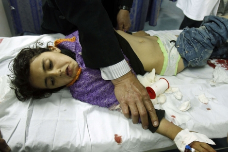 Un niña palestina herida en el hospital. | Afp
