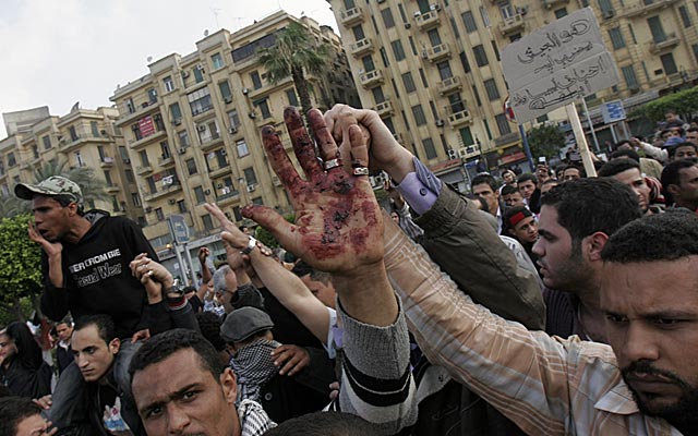 Un manifestante muestra su mano ensangrentada tras la intervención policial. | AP