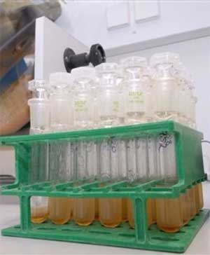 Muestras de orina en un laboratorio. (AP)