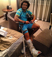 Marcelo, con su escayola, en el hotel.
