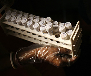 Muestras de sangre para un análisis de VIH ( Foto: Reuters | Jayanta Shaw) Muestras de sangre para un análisis de VIH ( Foto: Reuters | Jayanta Shaw)