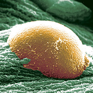 Imagen coloreada de la bacteria E. coli. (Foto: Science | Scott J. Hultgren y John Heuser)