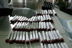 Un trabajador organiza unas muestras tomadas para la prueba del sida. (Reuters) Un trabajador organiza unas muestras tomadas para la prueba del sida. (Reuters)