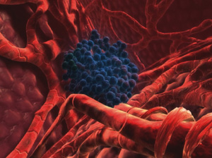 Detalle de una c&eacute;lula cancerosa que se desarrolla en el h&iacute;gado de una persona. (Global Cancer News | Merck)