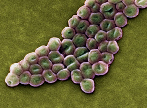 Imagen microsc&oacute;pica de la bacteria 'Acinetobacter baumannii', una de las que genera m&aacute;s resistencias. (Foto: Science Photo Library)