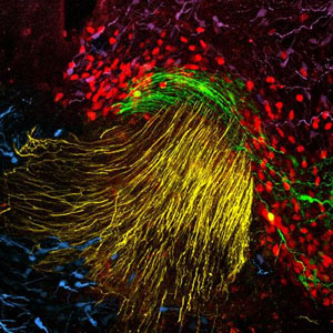 Neuronas (en rojo) que expresan el gen OTP. (Foto: CSIC) Neuronas (en rojo) que expresan el gen OTP. (Foto: CSIC)
