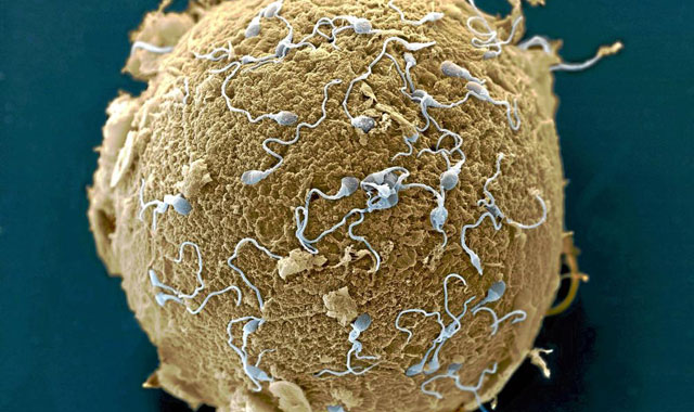 Un óvulo rodeado de espermatozoides. | Science Library