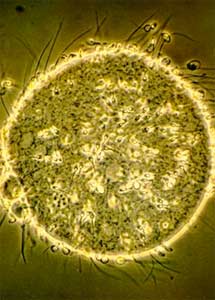 Espermatozoides intentando entrar en un óvulo. | Universidad de Utah Espermatozoides intentando entrar en un óvulo. | Universidad de Utah