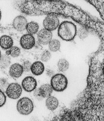 Imagen del Hantavirus. | CDC Imagen del Hantavirus. | CDC