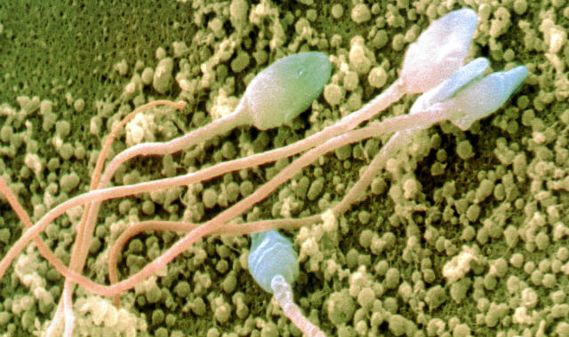 Espermatozoides humanos vistos bajo un microscopio. | Science Photo Library