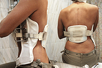 Apaleada. La joven de la imagen, de 28 a�os, ingres� en un hospital madrile�o con siete v�rtebras fracturadas o da�adas tras una brutal paliza de su novio. (Foto: Diego Sinova)