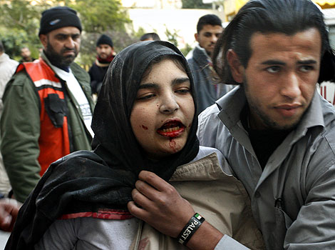 Una mujer herida a consecuencia de los ataques israelíes es hospitalizada en Beit Lahiya (Franja de Gaza). (Foto: AP)