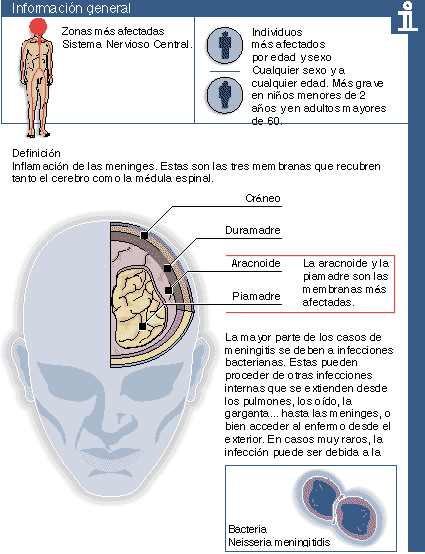 que es la meningitis sintomas causas y tratamiento que es la meningitis sintomas causas y tratamiento